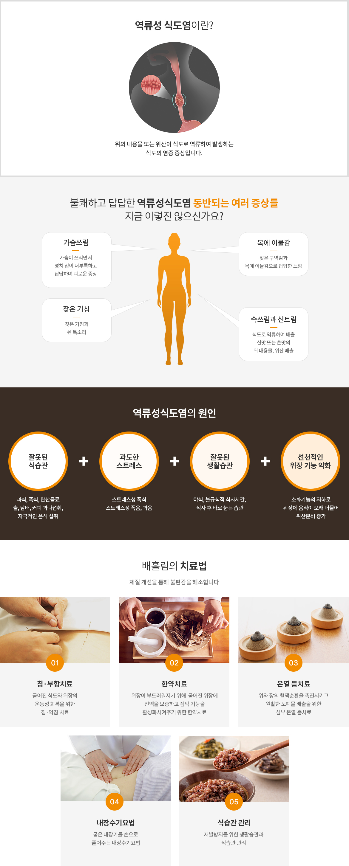 역류성식도염 이미지