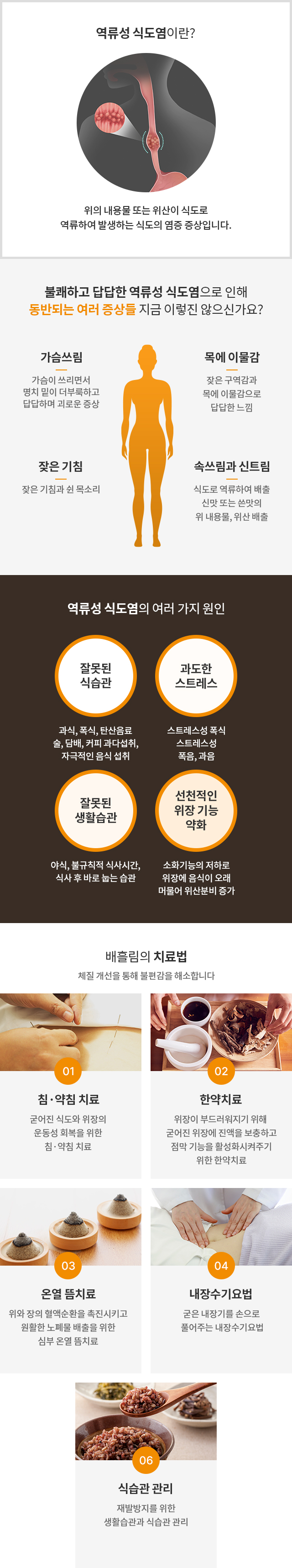 역류성식도염 이미지